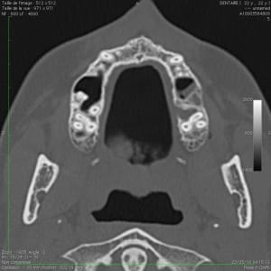Image suspecte 4 - Eugenol