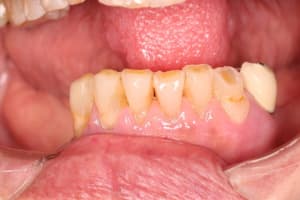 Img2 rfba88 - Eugenol