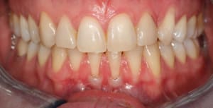 Img 6734 wcdndp - Eugenol