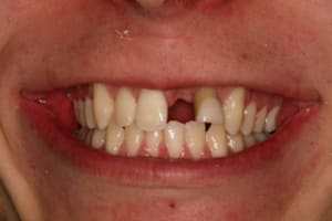 Img 7567 yr5fwo - Eugenol