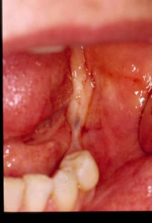 Initial dv7fiz - Eugenol