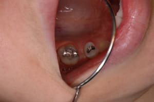Initial q4qqzf - Eugenol