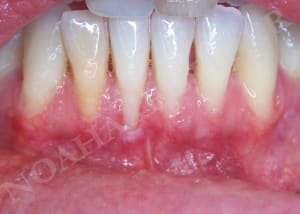 Initial roeu0t - Eugenol