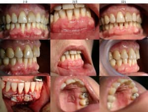 J0 j15 j21 urxgbr - Eugenol