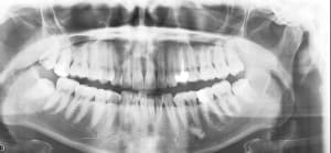 Jc1 xxsfnh - Eugenol
