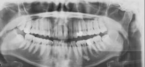 Jc2 cnej6w - Eugenol