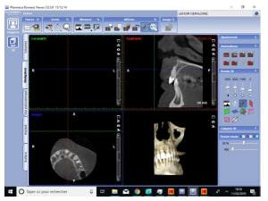 Jjt9teglpikub60bpz2v - Eugenol