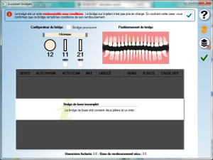 Julie bridgeextension eoqrmz - Eugenol