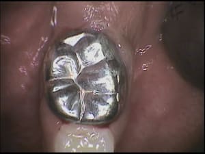 Ketucia um4two - Eugenol