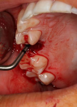 Letrou fhjbzi - Eugenol