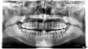 Lynyvjwvwjanfni2avfv - Eugenol