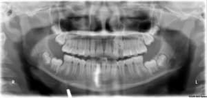 M1 ijybap - Eugenol