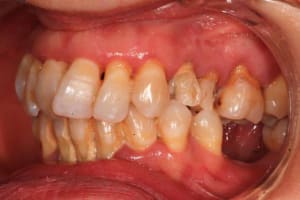 Mars2016 073 co7y56 - Eugenol