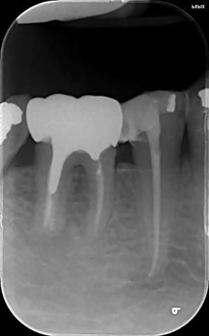 Matu 2 fzgz38 - Eugenol