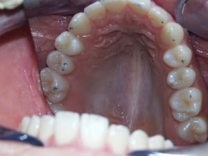 Max1 bhqcxf - Eugenol