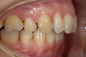 Me wv8msi - Eugenol