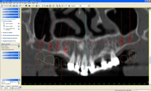 Medoverview ngdayl - Eugenol