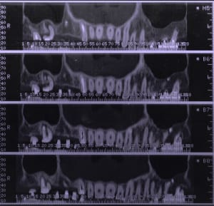 Mfscan4 hc6jma - Eugenol