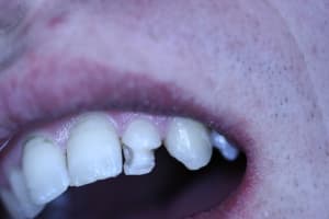 Milieu dp3eki - Eugenol