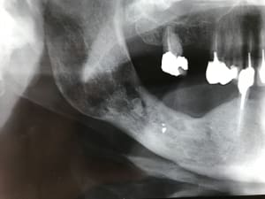 Mjxbhl92d18xodumr9y6 - Eugenol