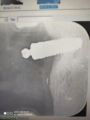 Ml1c3gzk0hcfxy1ulhda - Eugenol