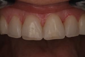Mockup4 emsu5c - Eugenol