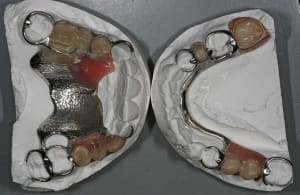Modèles occlusal qed2vn - Eugenol
