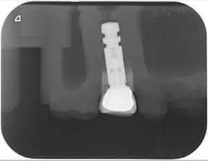 Modele ccmi trop courte flcup8 - Eugenol