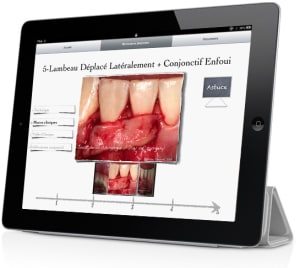 Montage imuco ipad 3 qyskks - Eugenol