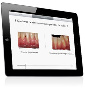 Montage imuco ipad 8 fpycgr - Eugenol