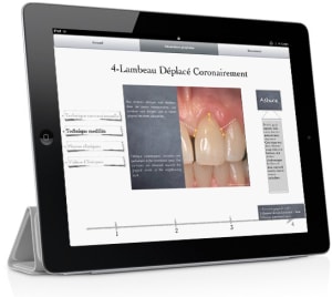 Montage imuco ipad 9 cyfpmk - Eugenol