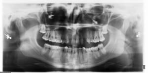 Multi djjweu - Eugenol