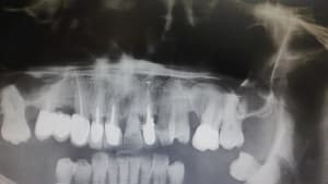 Mxcym3w0xv88utiwvbhm - Eugenol