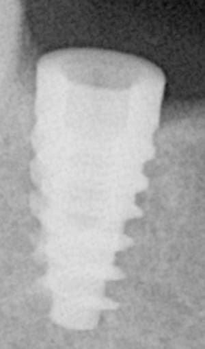 Ndzjlfwmaveuldqzk74l - Eugenol