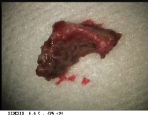 Necrose1 ljgdzz - Eugenol