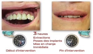 Niz2rbk0yn9aypmzgzk7fbu9tsnu - Eugenol