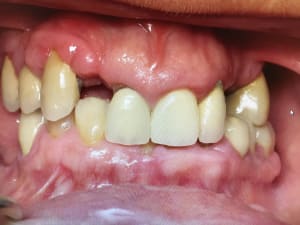 Nizrclgg9zfi7t1k7vzy - Eugenol