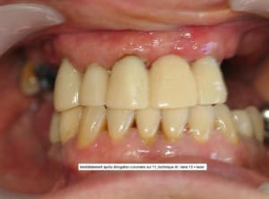 Non centrage 3 jxi5rz - Eugenol