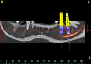 Od panoramic of1jkh - Eugenol