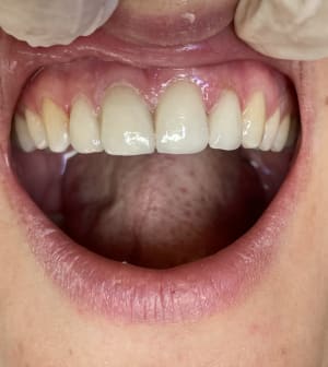 Odgx1gsvtydh7ljelkgw - Eugenol