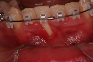 Oops gzxmey - Eugenol