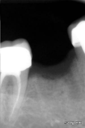 Osnov2009 owo51g - Eugenol