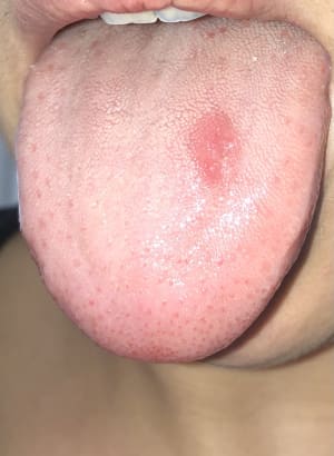 Owg0kuqgigyga5pidqn3 - Eugenol
