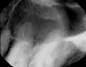 Oxhxxffxxuoh7huonpzk - Eugenol