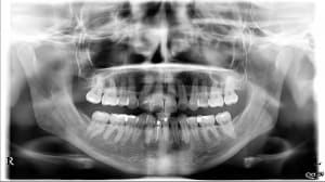 Oyzt2irp5evtvukwfgag - Eugenol