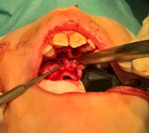 Ozllrofecdhrglrgwagn - Eugenol