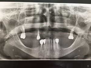 Ozqef88wcne3oklinwlj - Eugenol