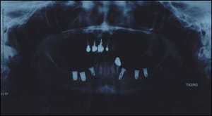 P1 g2udkz - Eugenol