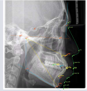 P7sn9ryz7bxnc9p97hr71ftrkdbp - Eugenol