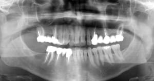 Pano 01042016 exusho - Eugenol